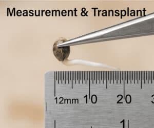A cannabis seed with a sprouted white taproot held in tweezers next to a metric ruler for measurement.